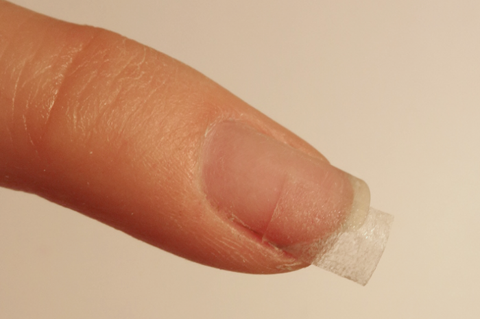 Uszkodzenia mechaniczne paznokci